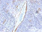 von Willebrand Factor/Factor VIII Related-Ag (Endothelial Marker) Antibody in Immunohistochemistry (Paraffin) (IHC (P))