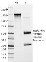 von Willebrand Factor/Factor VIII Related-Ag (Endothelial Marker) Antibody in SDS-PAGE (SDS-PAGE)