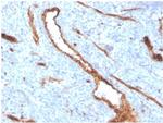 von Willebrand Factor/Factor VIII Related-Ag (Endothelial Marker) Recombinant Rabbit Monoclonal Antibody (VWF/4384R)