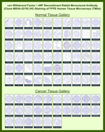 von Willebrand Factor/Factor VIII Related-Ag (Endothelial Marker) Recombinant Rabbit Monoclonal Antibody (MSVA-521R)