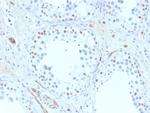 Wilm's Tumor 1 (WT1) (Wilm's Tumor and Mesothelial Marker) Antibody in Immunohistochemistry (Paraffin) (IHC (P))