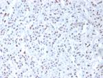 Wilm's Tumor 1 (WT1) (Wilm's Tumor and Mesothelial Marker) Monoclonal Antibody (6F-H2)