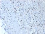 Wilm's Tumor 1 (WT1) (Wilm's Tumor and Mesothelial Marker) Monoclonal Antibody (SPM361)