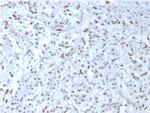 Wilm's Tumor 1 (WT1) (Wilm's Tumor and Mesothelial Marker) Monoclonal Antibody (WT1/857)
