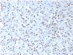 Wilms Tumor 1 (WT1) Recombinant Mouse Monoclonal Antibody (rWT1, 857)