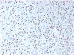 Wilms Tumor 1 (WT1) Recombinant Rabbit Monoclonal Antibody (WT1, 1434R)