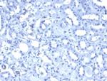 Wilms Tumor 1 (WT1) Recombinant Rabbit Monoclonal Antibody (WT1, 3477R)