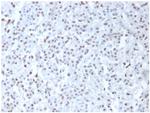 Wilm's Tumor 1 (WT1) (Wilm's Tumor and Mesothelial Marker) Polyclonal Antibody