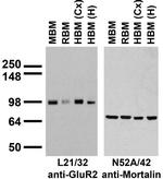 GluA2/GluR2 Glutamate Receptor Antibody in Western Blot (WB)