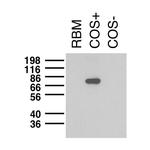 Kv1.5 K+ Channel Antibody in Western Blot (WB)