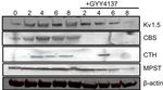 Kv1.5 K+ Channel Antibody in Western Blot (WB)