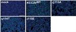 KCC2 Monoclonal Antibody (N1/12)