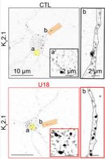 Kv2.1 K+ Channel Antibody in Immunocytochemistry (ICC/IF)