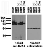 Kv2.1 K+ Channel Antibody in Western Blot (WB)