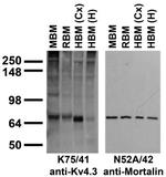 Kv4.3 K+ Channel Antibody in Western Blot (WB)