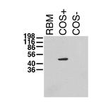 Kvbeta1.1 K+ Channel Antibody in Western Blot (WB)