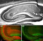 Slo1 Maxi-K+ Channel Antibody in Immunohistochemistry (Frozen) (IHC (F))