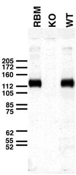 Slo1 Maxi-K+ Channel Antibody in Western Blot (WB)