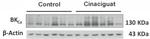 Slo1 Maxi-K+ Channel Antibody in Western Blot (WB)
