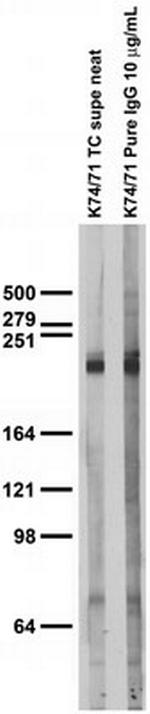 Nav1.1 Na+ Channel Antibody in Western Blot (WB)