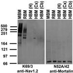 Nav1.2 Na+ Channel Antibody in Western Blot (WB)