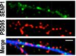 PSD-95 Antibody in Immunocytochemistry (ICC/IF)