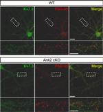 PSD-95 Antibody in Immunocytochemistry (ICC/IF)