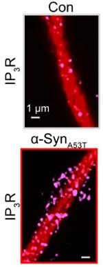 IP3 Receptor/Type 1 Antibody in Immunocytochemistry (ICC/IF)