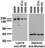 IP3 Receptor/Type 1 Antibody in Western Blot (WB)