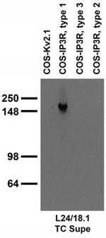 IP3 Receptor/Type 1 Antibody in Western Blot (WB)