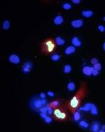 Co-Rest/RCOR1 Monoclonal Antibody (K72/8)