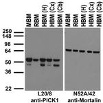 PICK1 Antibody in Western Blot (WB)