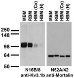 Kv3.1B K+ Channel Antibody in Western Blot (WB)