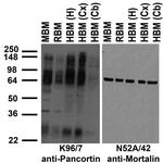 Pancortin Antibody in Western Blot (WB)