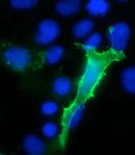 TrpV3 Monoclonal Antibody (N15/4)