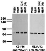 WAVE1/SCAR Antibody in Western Blot (WB)
