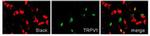 Slo2.2/Slack K+ Channel Monoclonal Antibody (N3/26)