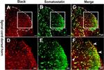 Slo2.2/Slack K+ Channel Antibody in Immunohistochemistry (Frozen) (IHC (F))