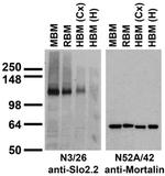 Slo2.2/Slack K+ Channel Antibody in Western Blot (WB)