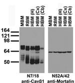 Cavbeta1 Ca2+ Channel Antibody in Western Blot (WB)