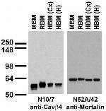 Cavbeta4 Ca2+ Channel Antibody in Western Blot (WB)