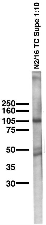 KCNU1/Slo3 pH-Sensitive Maxi-K+ Channel Antibody in Western Blot (WB)