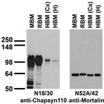 Chapsyn-110/PSD-93 Antibody in Western Blot (WB)