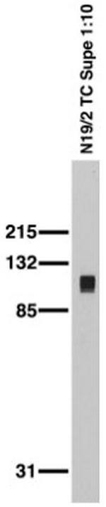SAP102 Antibody in Western Blot (WB)