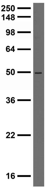 Pink1 PTEN Induced Putative Kinase 1 Antibody in Western Blot (WB)