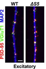 VGlut1 Monoclonal Antibody (N28/9)