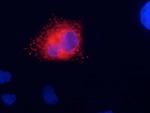Kv7.1/KCNQ1 K+ Channel Antibody in Immunocytochemistry (ICC/IF)