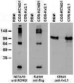 Kv7.1/KCNQ1 K+ Channel Antibody in Western Blot (WB)