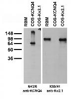 Kv7.4/KCNQ4 K+ Channel Antibody in Western Blot (WB)