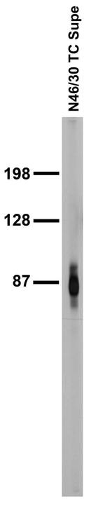 ADAM22 (Cytoplasmic) Antibody in Western Blot (WB)